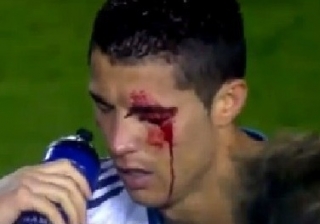 Ronaldo al-qana boyandı